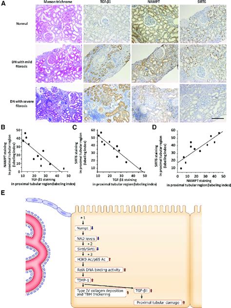 Tubular Nampt Sirt And Tgf B Immunostaining In Human Renal Biopsy