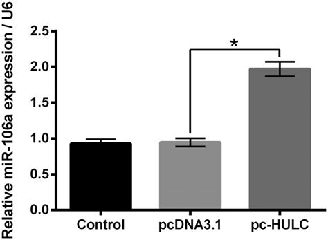 HULC Overexpression Raised The MiR 106a Expression In TPC 1 Cells