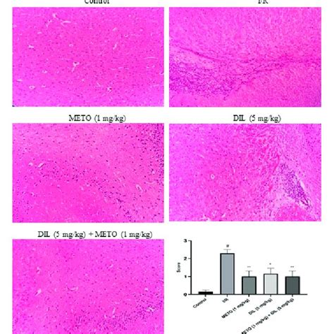 -(A) Photomicrographs of brain stained with H&E after cerebral ...