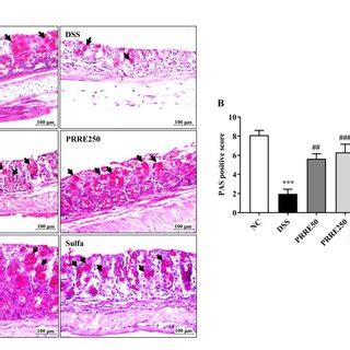 The Effects Of PRRE On Mucin Secreting Goblet Cells In DSS Induced