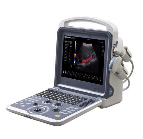 Portable Color Doppler K2 USG Machine China Ultrasound And Ultrasound