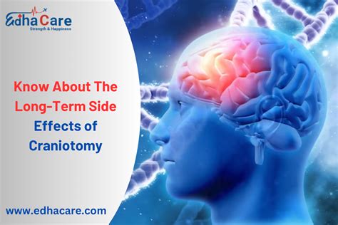 Do You Know About The Long-Term Side Effects of Craniotomy?