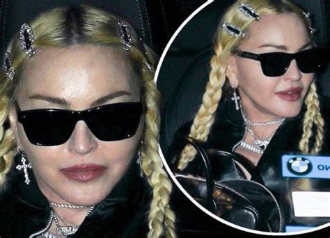 Madonna Plastic Surgery Daily Mail Everything You Should Know On Plastic Surgery Of Madonna