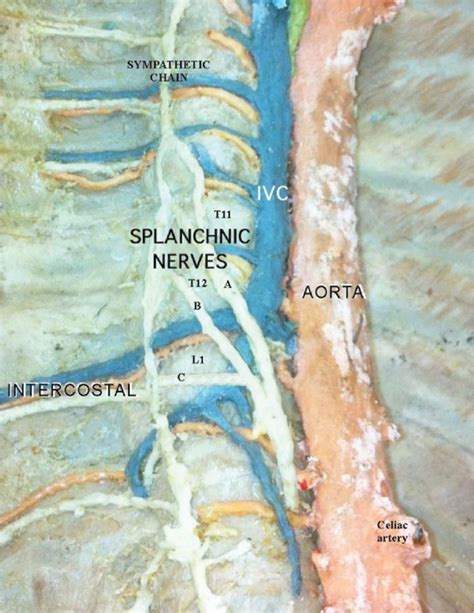 Splanchnic Nerve Blocks | Anesthesia Key