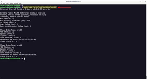 How To Configure Network Bonding In Linux Ostechnix