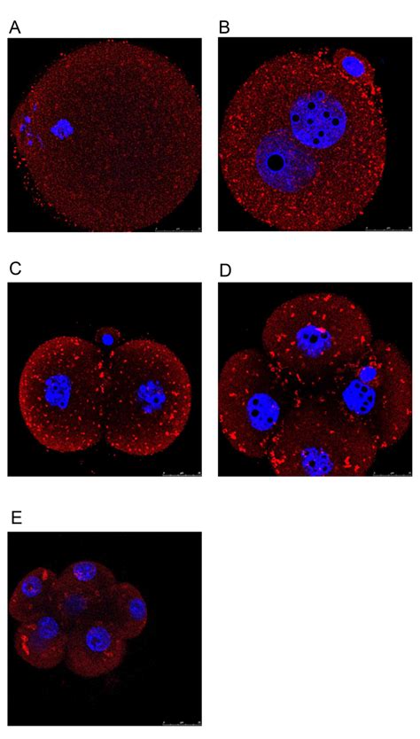 Dynamic Expression Of Epac And Rap In Mouse Oocytes And