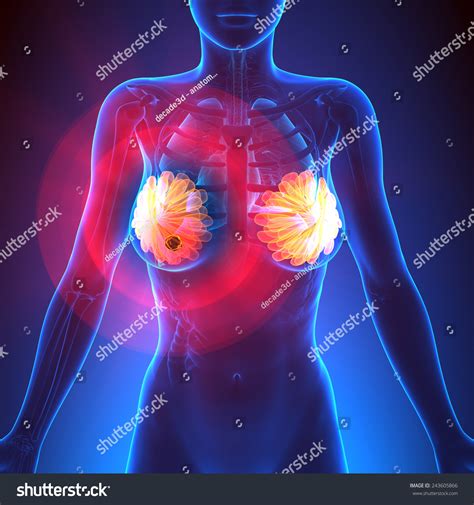 Breast Cancer Female Anatomy Stock Illustration