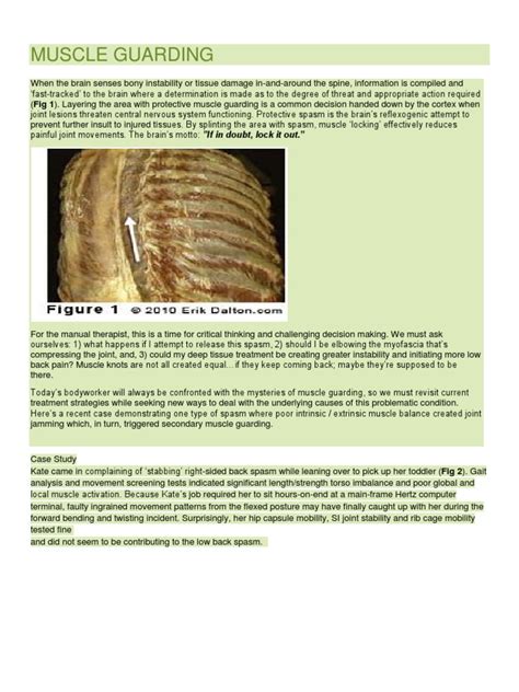 Muscle Guarding | Back Pain | Vertebra