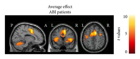 Brain Regions Showing Significant Activation Colour Coded With