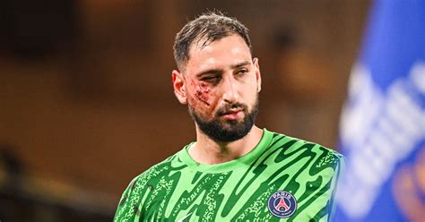 Donnarumma Dans Un Sale Tat