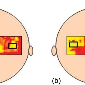 Group Level Activation T Maps Induced By The Finger Movement Task On