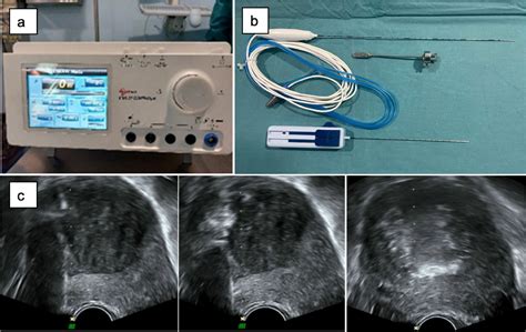 Efficacy Complications And Factors Predictive Of Response To