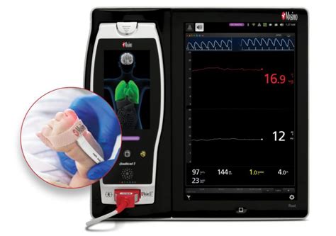 Masimo obtains CE mark for haemoglobin monitoring device SpHb