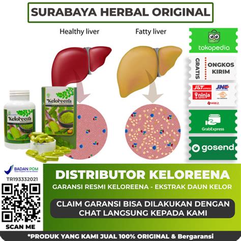 Jual Obat Herbal Fatty Liver Perlemakan Hati Berlemak Keloreena Asli