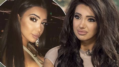 chloe khan  died  operating table  undergoing latest nose