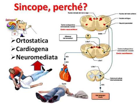 S Ncope Neurologico Guida Completa Alle Cause E Sintomi Spazio Bluonlus