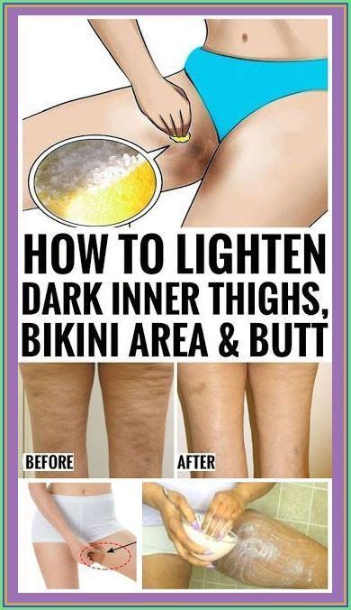 How To Lighten Dark Inner Thighs Naturally Artofit