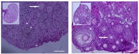 Microphotographs Of 3 Dpp And Adult Mouse Ovaries Sections Were