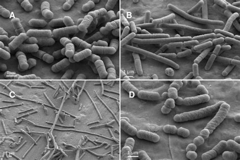 Lactobacillus sakei - Alchetron, The Free Social Encyclopedia