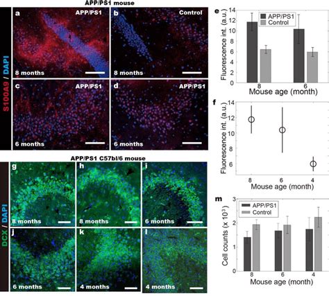 Increased expression of S100A9 in hippocampus of APP/PS1 mice. (a,b ... 