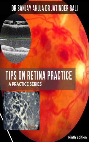 Tips On Retina Practice Ninth Edition By Sanjay Ahuja Jatinder Bali