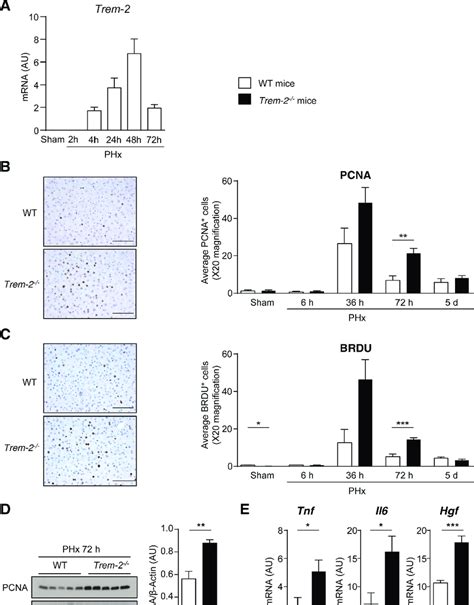 Role Of Trem In Liver Regeneration And Hepatocyte Proliferation After