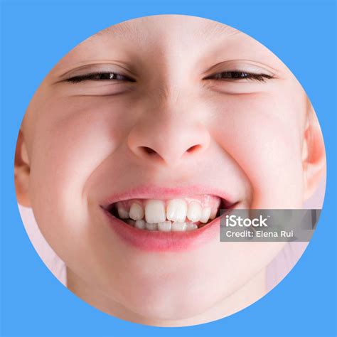 Crooked Teeth Cumberland Dental Dental Treatments