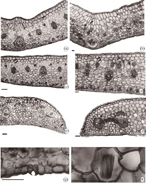 Photomicrographs In Optical Microscopy Of The Leaf Blades Of The Download Scientific Diagram