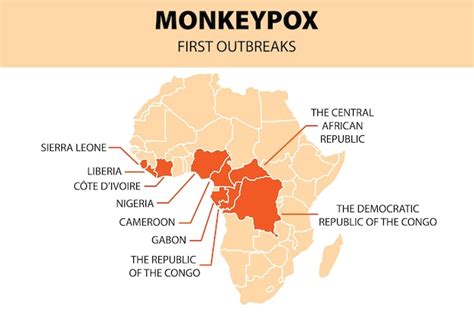 Infographie Du Virus Monkeypox Carte Africaine Des Premières épidémies