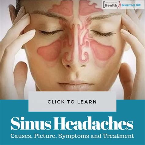 Sinus Headaches Causes Picture Symptoms And Treatment