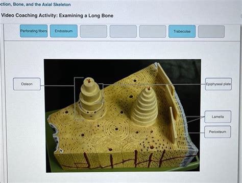 Solved Ction Bone And The Axial Skeleton Video Coachin