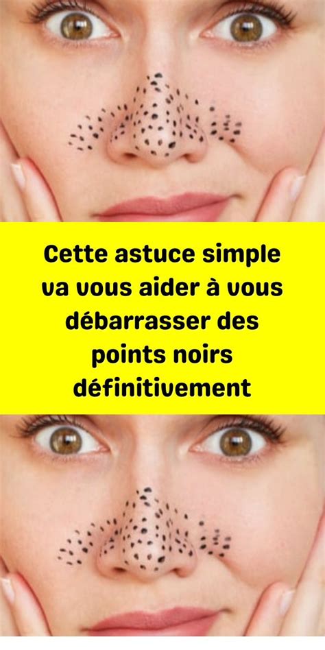 Cette astuce simple va vous aider à vous débarrasser des points noirs