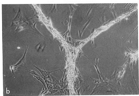 Figure 1 From Role Of Laminin And Basement Membrane In The