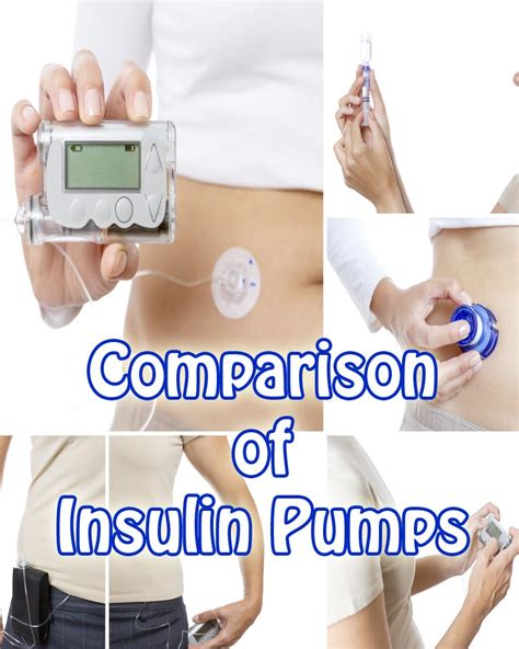 Comparison of Insulin Pumps