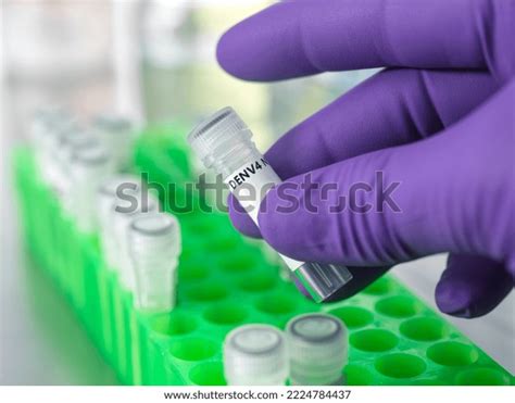 Scientist Holding Vial Containing Protein Dengue Stock Photo 2224784437