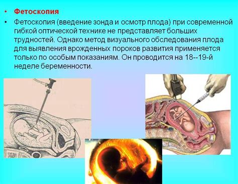 Фетоскопия: показания, противопоказания и техника проведения