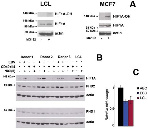 Expression Level Of HIF1A In EBV Infected And Mitogen Activated