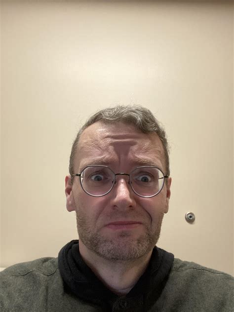 What is going on with my forehead? Skin is weird y’all. Hell, life is