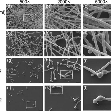 Effects Of Ee On C Albicans Biofilm Formation Shown In Clsm Images Download Scientific