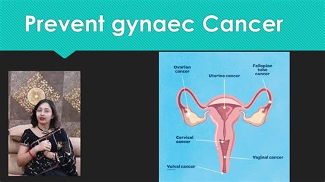 Cancer Prevention Tips For Females How To Prevent Cervical Cancer Youtube