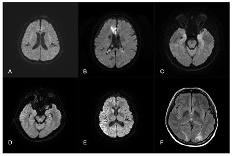 Diagnostics Free Full Text Brain Imaging In Epilepsy Focus On