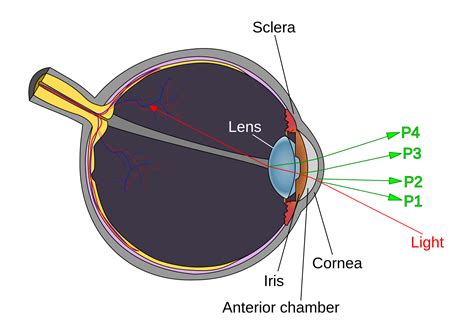 What Is Causing The Twinkle In A Patients Eye Consultant360