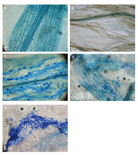 Microphotographs Of Roots Stained For Mycorrhizal Association