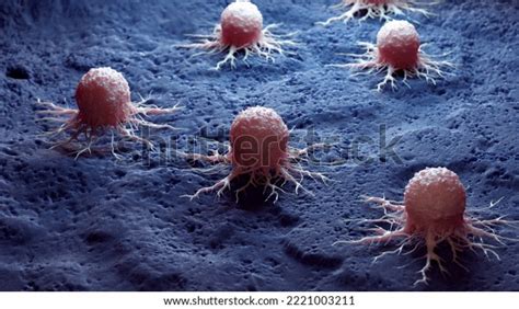 3d Rendered Medical Illustration Cancer Cell Stock Illustration 2221003211 Shutterstock