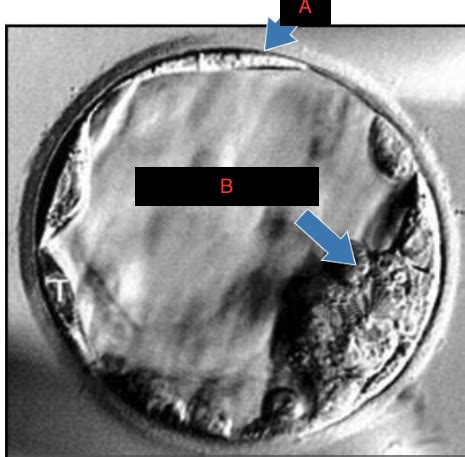 BMS 133 Early Embryology And Branchial Arch Development Flashcards