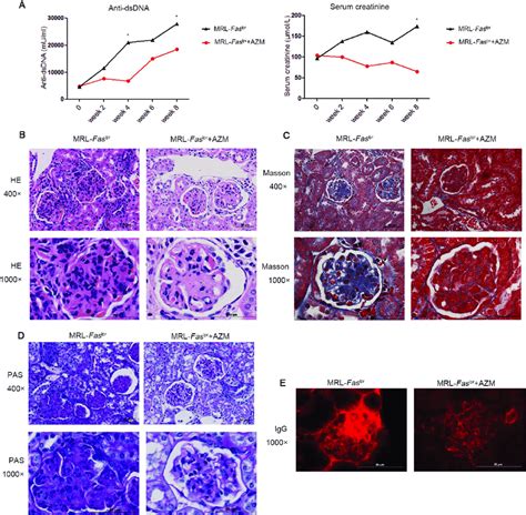 Azithromycin Alleviated Symptoms Of Lupus In Mrl Fas Lpr Mice In Vivo