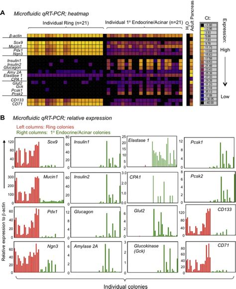 Cd133highcd71low Cell Derived Ring Or 1° Endocrineacinar Colonies