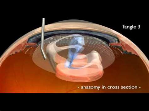 Anatomy in Cross Section - YouTube