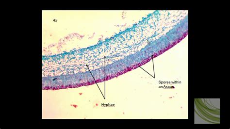 Peziza Under Microscope Labeled