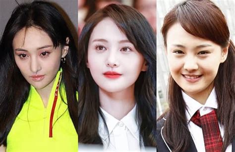 Zheng Shuang’s New Face Spurs Plastic Surgery Rumors – JayneStars.com